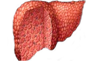 celulas madre en cirrosis